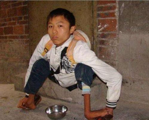 小乞丐吃瓜视频,吃瓜视频引发网友热议  第2张